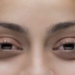Ojos rojos o weed eyes