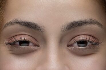 Ojos rojos o weed eyes