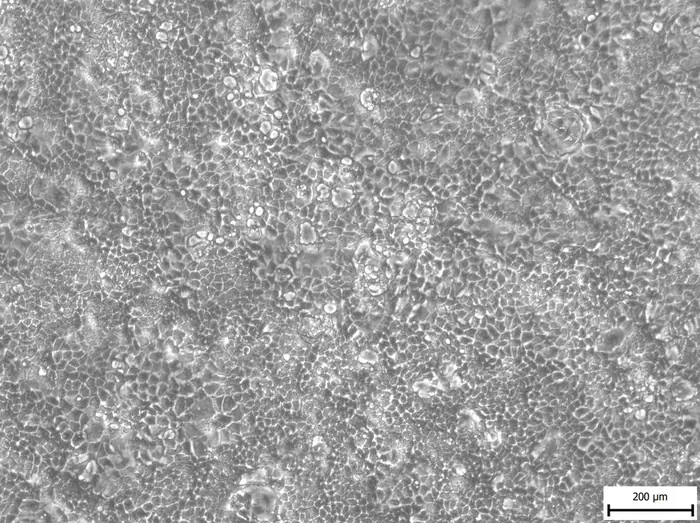 Células Caco-2 de cáncer de colon humano vistas al microscopio